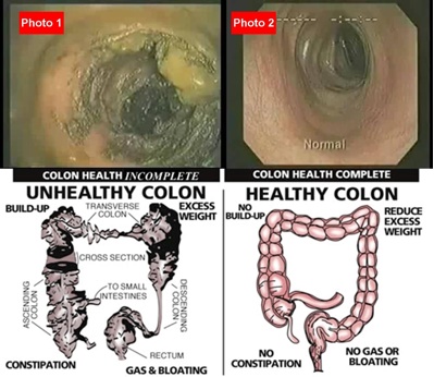 Detailansicht des Touchscreen-Bedienfelds der colon hydrotherapy machine